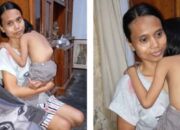 Qabila, Gadis Kecil Asal Nglegok Blitar dengan Tulang Belakang Bengkok, Berjuang di Tengah Keterbatasan