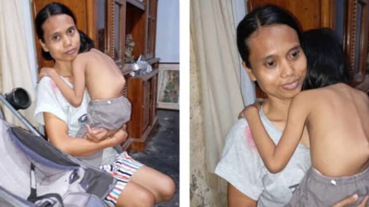 Qabila, Gadis Kecil Asal Nglegok Blitar dengan Tulang Belakang Bengkok, Berjuang di Tengah Keterbatasan